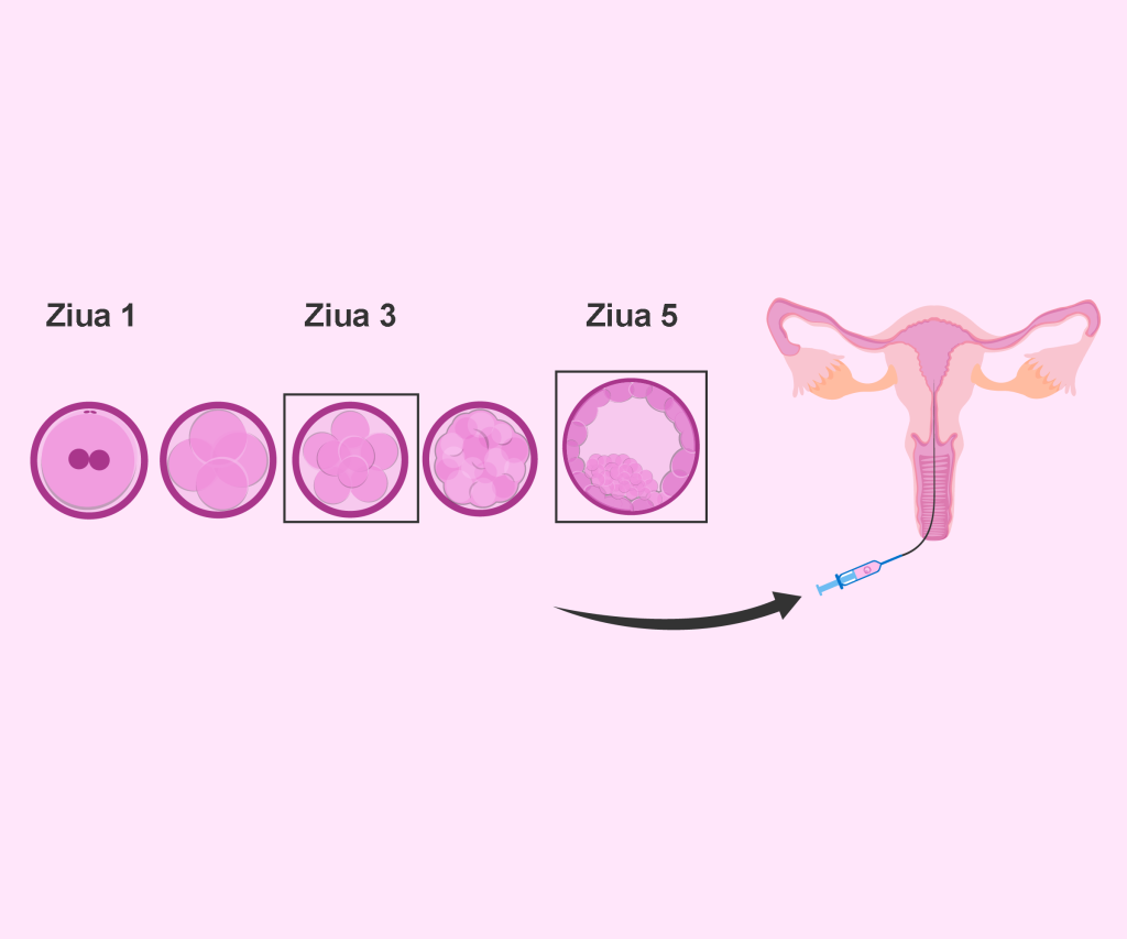 Transfer-embrion-de-ziua-5-versus-ziua-3-pwZ6