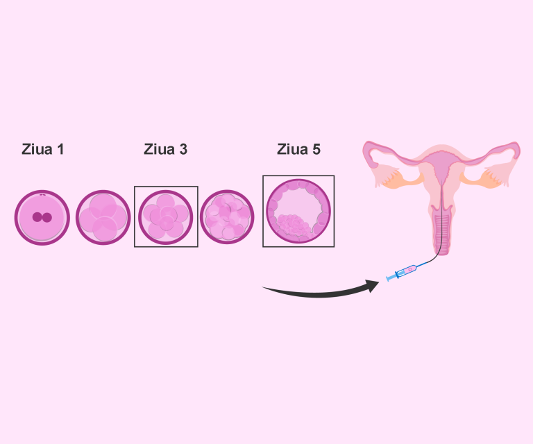 Transfer-embrion-de-ziua-5-versus-ziua-3-pwZ6